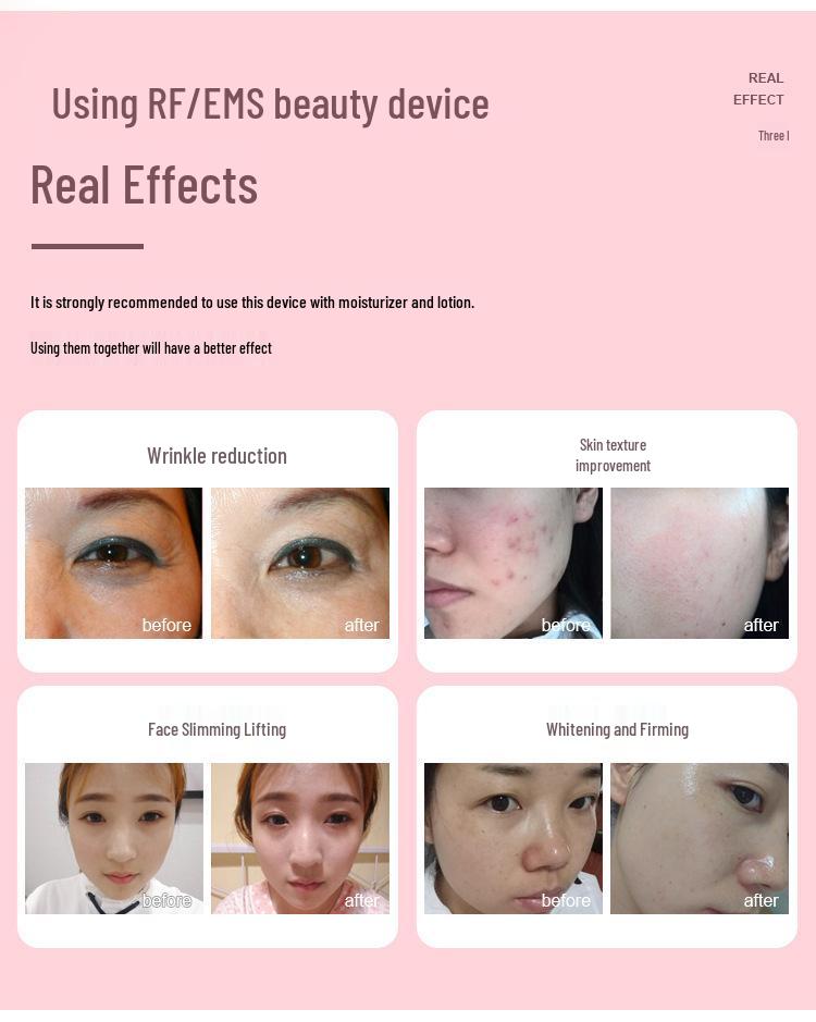 Home Facial Massager: Nasolabial Lift, Firming & Photon Rejuvenation Cleanser