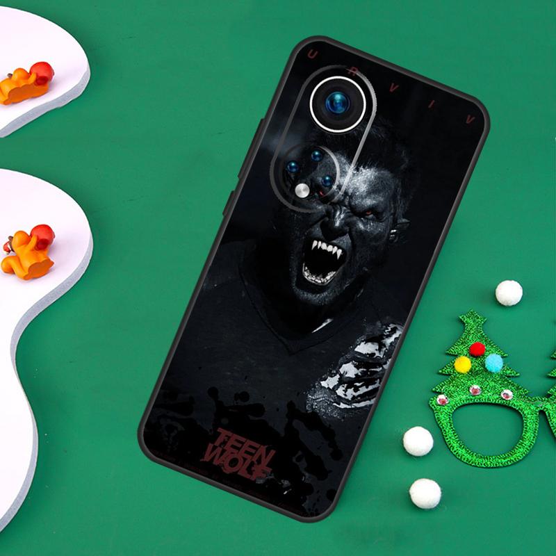 Teen Wolf Case For Honor Magic 7 Pro 6 5 50 70 90 200 Lite X9b X9a X8a X8b X7a X6a X8 X9 X9c Cover