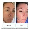 Replenix Age Restore Bio-Repair Serum: Anti-aging serum with hyaluronic acid for moisturizing and dry skin care. Fragrance-free. 50ml