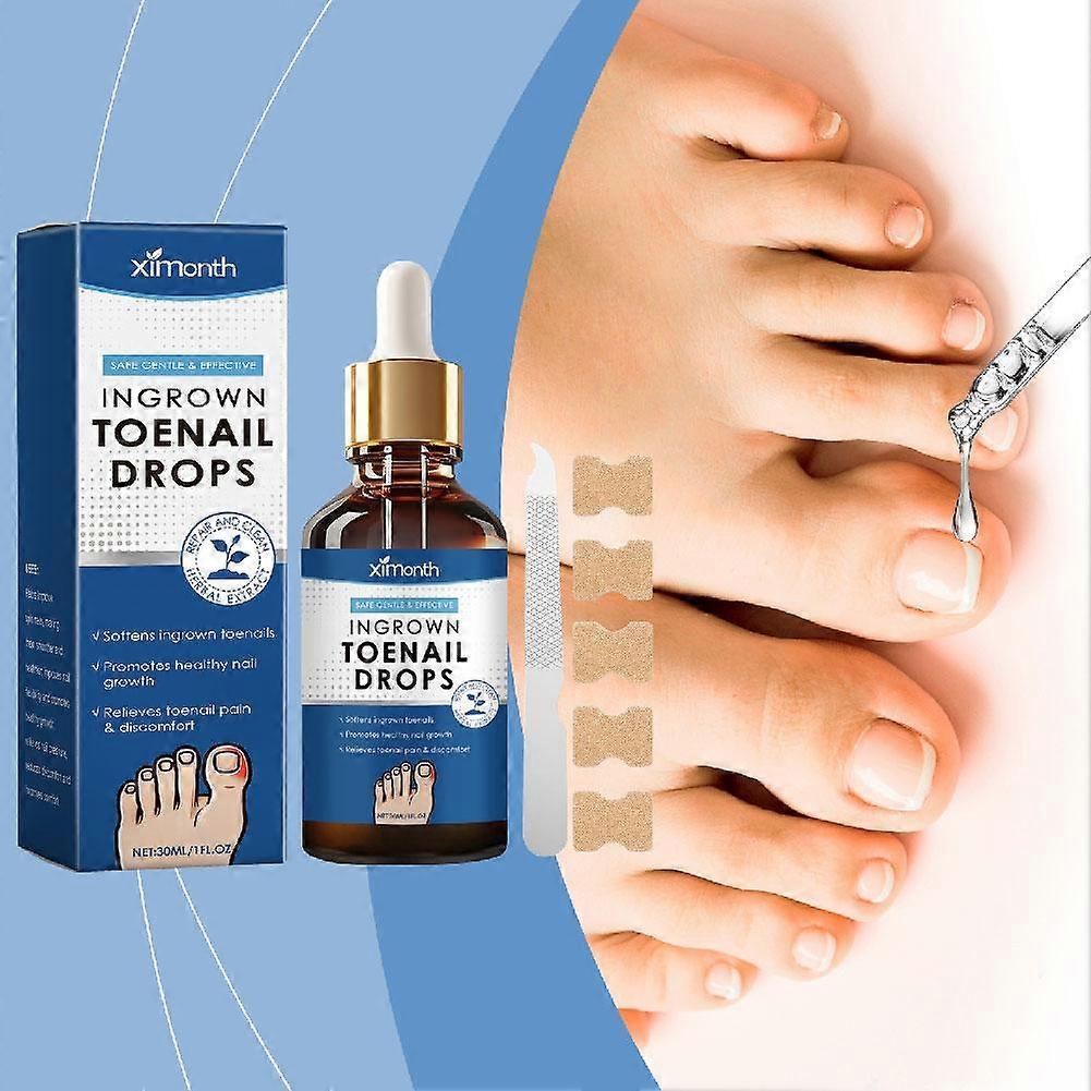 Ingrown Toenail Treatment. Ingrown Nail Repair Serum