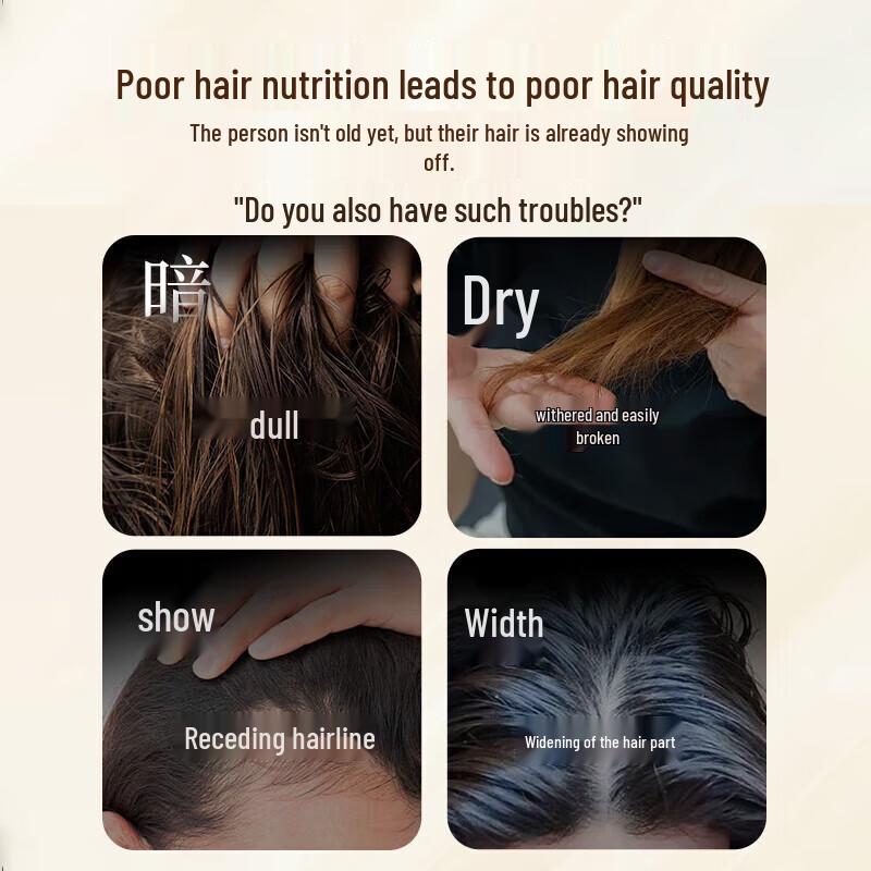BAWANG Polygonum Multiflorum Anti-Haarausfall Shampoo
