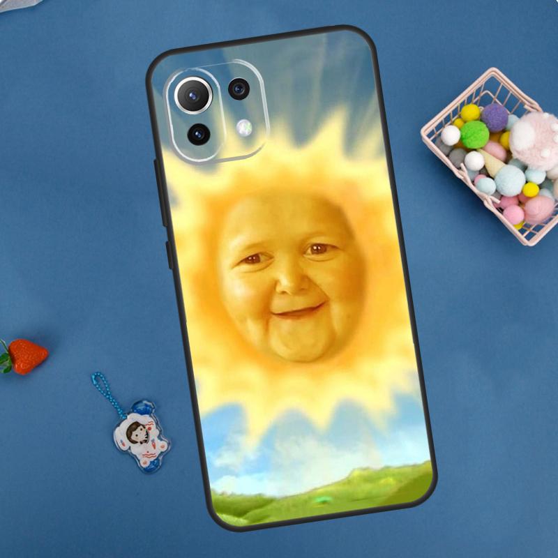 Funny Hasbulla Case For Xiaomi 14 13 15 Ultra 11T 12T 13T 14T Pro POCO X7 Pro X3 X5 F5 F6 M6 X6 Pro Cover
