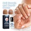 Ingrown Nail Repair Solution Safe Painless Anti-Fungal Toe Care Serum for Men & Women Nail Fungus Treatment 15ml