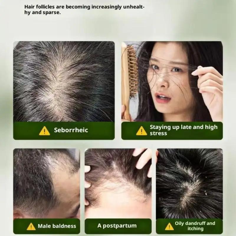 Usman Grass & Platycladus Shampoo Soap Strengthen Hair Root Growth Shampoo Bar Natural Herbal Hair Loss Treatment Hair Care