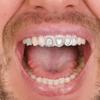 Fashionable Metal Fang Grillzs Hollow Teeth Jewelry Copper Texture Dental Accessory Suitable for Parties and Event
