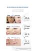 377 Brightening Skincare Set: Face Cream & Toner for Whitening Treatment and Spot Removal