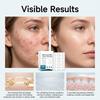 Microneedle Patches for Pimples and Blemishes, Face Stickers for Breakouts, Overnight Pimple Patch for Zits