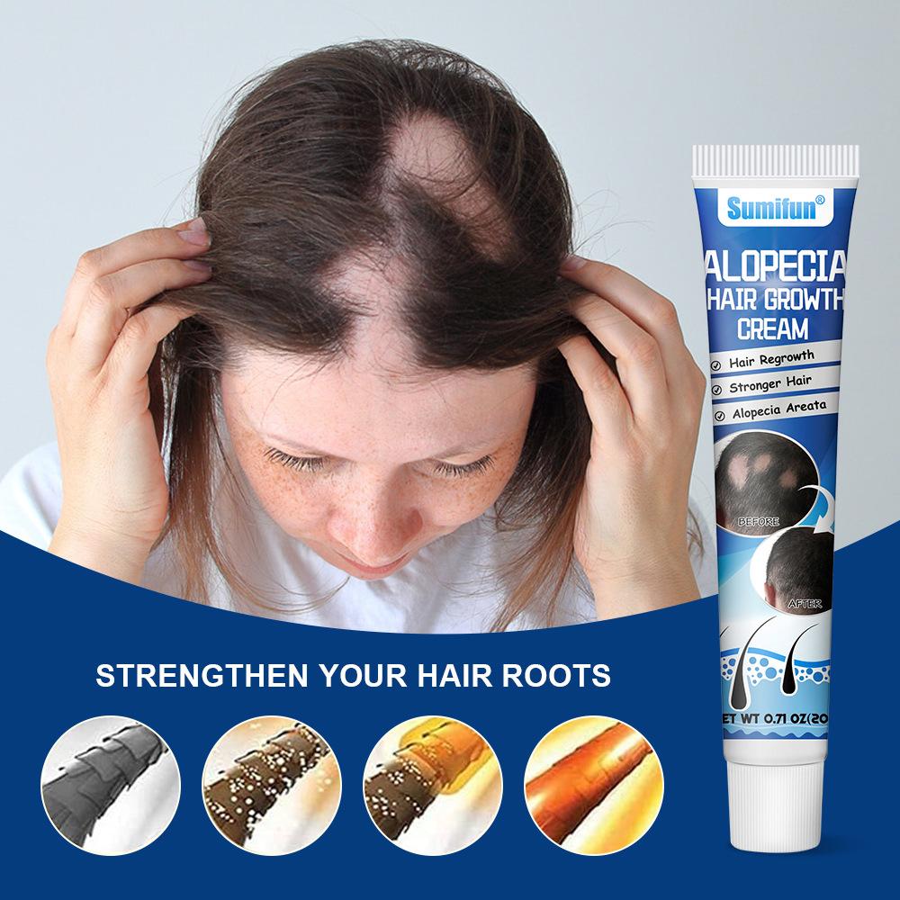 Sumifun Sophora Flavescens Balding Cream Scalp Care Hair Treatment for Men and Women Moisturizing Scalp Promote Hair Growth