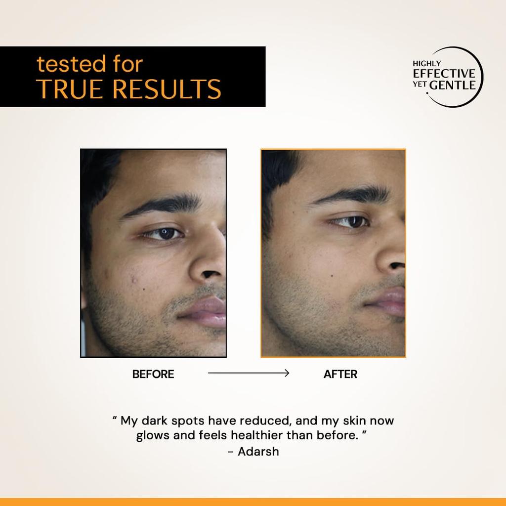 Deconstruct 10% Vitamin C Serum for Oily Skin| Clinically Tested to be Non-Irritating| No Purging| With 0.5% Ferulic Acid| For Men and Women| 30ml