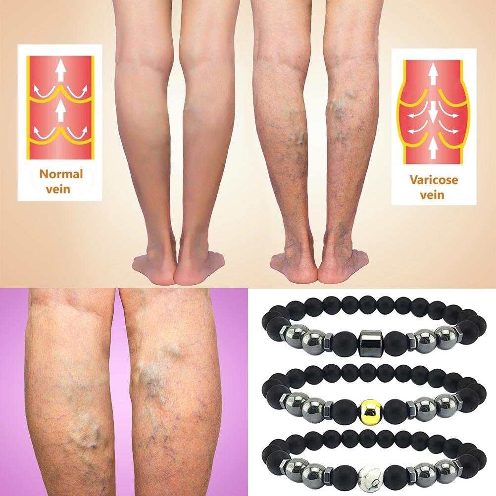 5Pcs Anti Swelling Black Obsidian Anklet Magnetic Therapy Bracelet Adjustable Weight Loss Magnet Anklet for Men Women