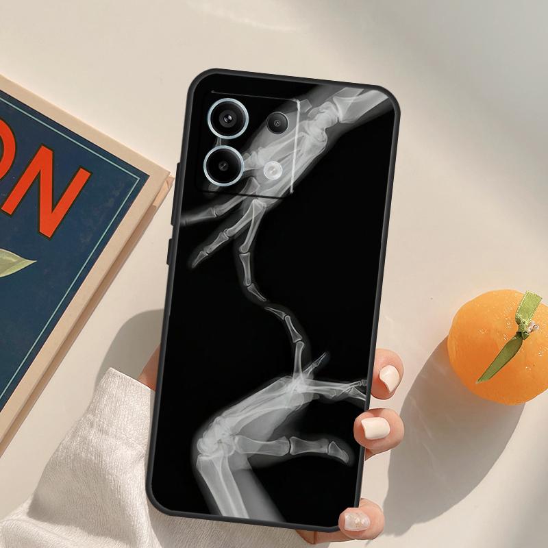 Xray Art Aesthetic Skull Funda For Xiaomi Redmi Note 14 13 Pro 9 10 11 12 9S 10S 11S 12S Redmi 13C 10C 12C 14C Case