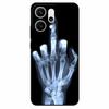 For Oppo Reno14 Pro/ Reno14 5G Case Black TPU Silicone Back Cover Case For Reno14 Pro 5G PKZ110 Bumper Phone Funda Reno14 PLA110