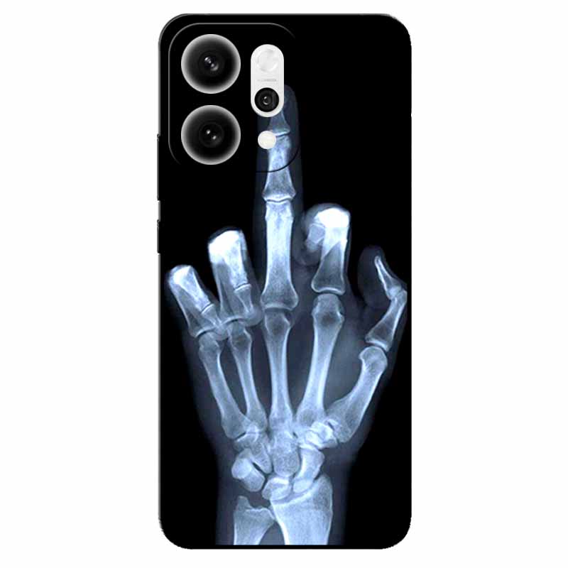 For Oppo Reno14 Pro/ Reno14 5G Case Black TPU Silicone Back Cover Case For Reno14 Pro 5G PKZ110 Bumper Phone Funda Reno14 PLA110