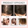 HOEGOA Honey Nourishing Hair Oil Scalp Care Essence nourishes the scalp, absorbs nutrients, and smoothes hair.