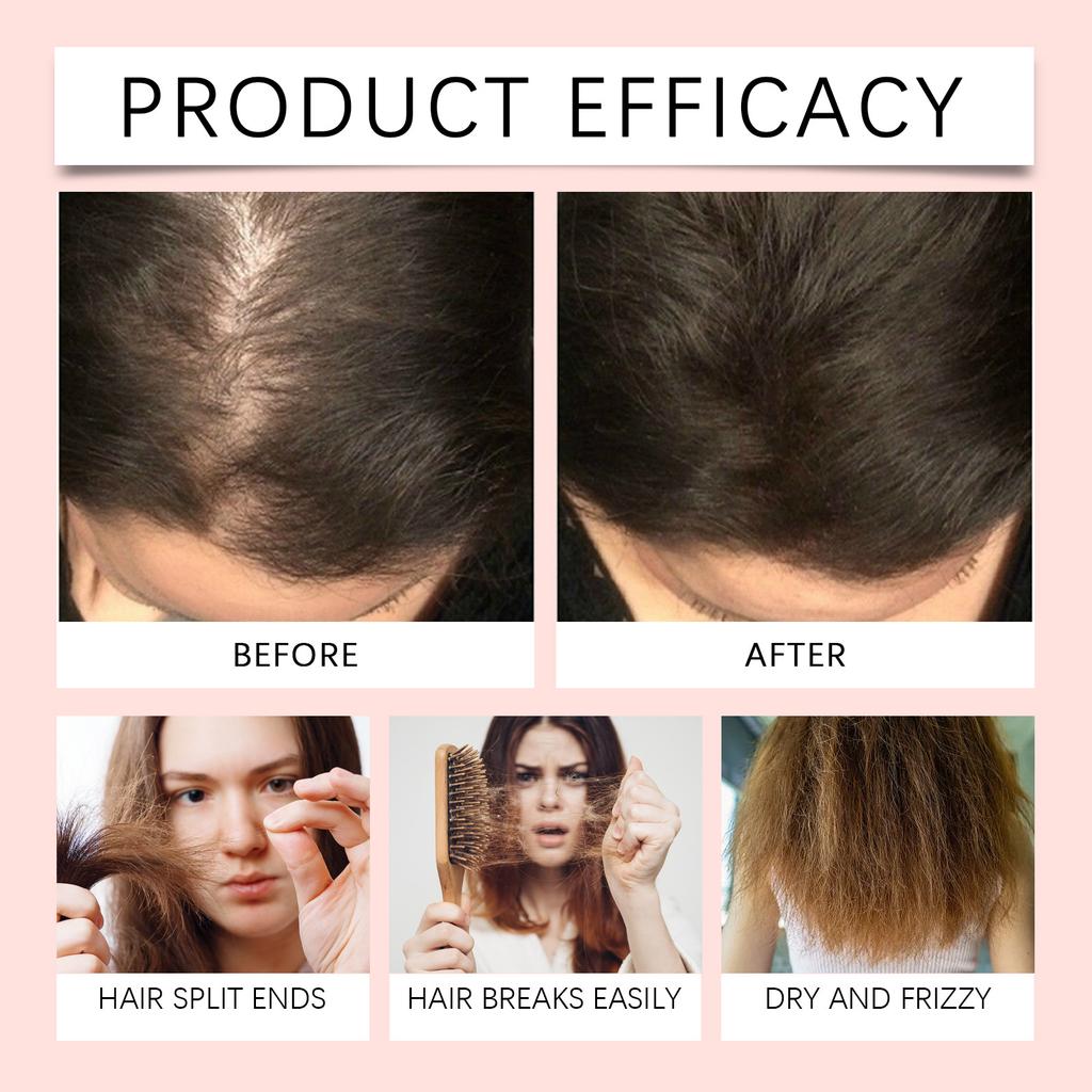HOEGOA Honey Nourishing Hair Oil Scalp Care Essence nourishes the scalp, absorbs nutrients, and smoothes hair.