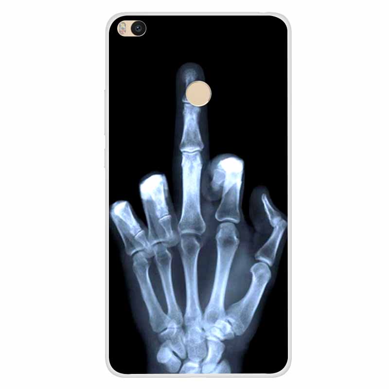 For Xiaomi Mi Max 2 Case Shockproof Soft silicone TPU Back Cover For Xiaomi Mi Mix 2 2S 3 Phone Case Mix2 Max2 Case Cute Cartoon