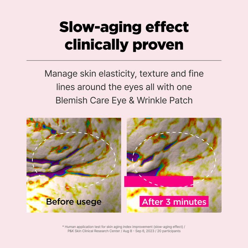 [ISOI] Blemish Care Eye & Wrinkle Patch