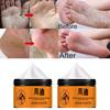 Foot Cream Heel Crack Repair Cream Dead Skin Removing Hand and Foot Care Moisturizing Cream