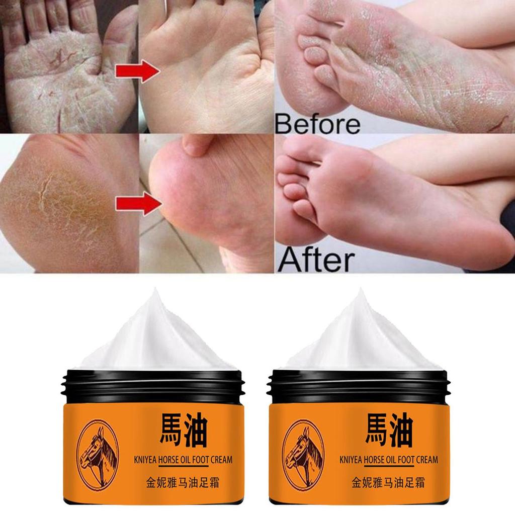Foot Cream Heel Crack Repair Cream Dead Skin Removing Hand and Foot Care Moisturizing Cream