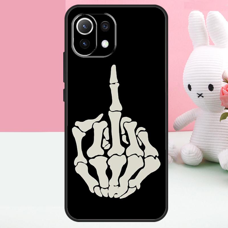 Skeleton Middle Finger Case For Xiaomi 15T 13T 14T 17 Pro Max 15 14 Ultra POCO X7 Pro X5 X6 F5 F6 F7 F8 Ultra Funda