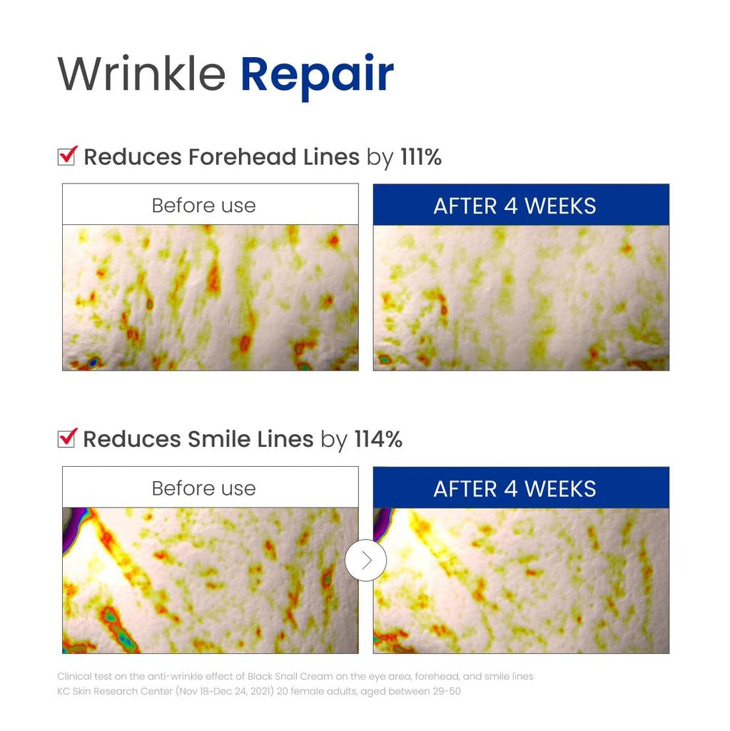 Dr.G Black Snail Cream (50 ml)