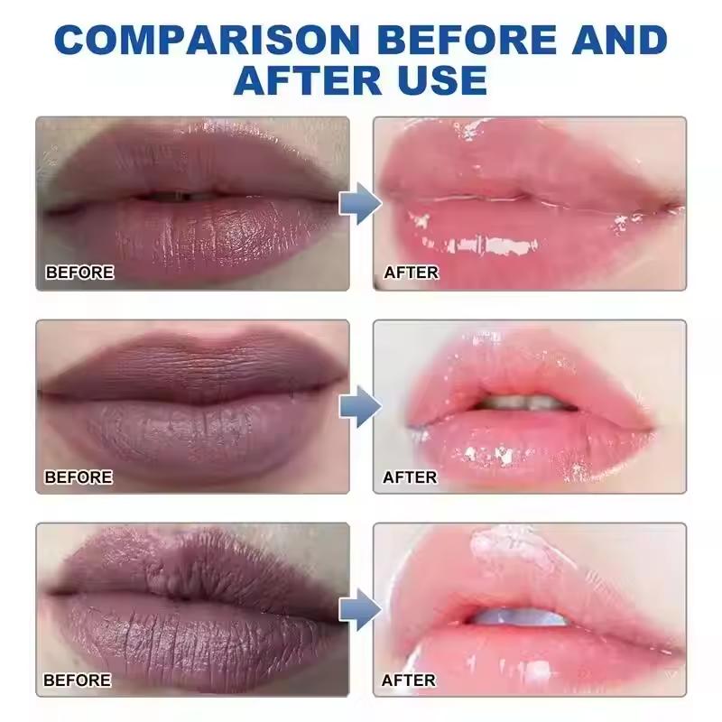Remove Dark Smoke Lip Balm Lightening Melanin Bleaching Gloss Oil Lips Pink Lipstick Exfoliating Fade Lip Lines Korean Cosmetics