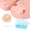 Professional Ingrown Toenail Corrector Pedicure Toe Nail Treatment Foot Correction Patch Stickers Embed Care Tool for Nail