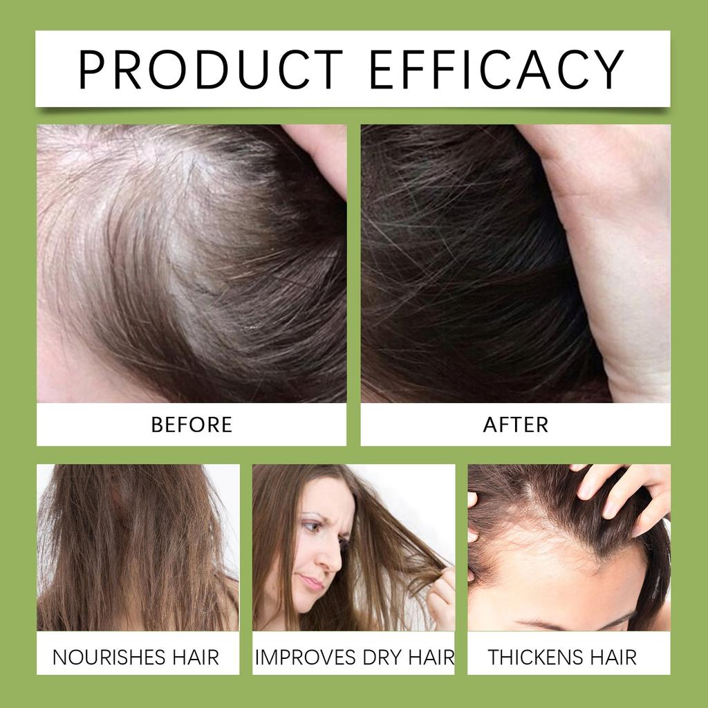 Jojoba Oil, Moisturizing Oil For Face, Hair, Skin And Nails Organic Jojoba Oil Premium Oil For Skin And Hair Anti-Aging Oil Cold And Hexane Free, 30ML