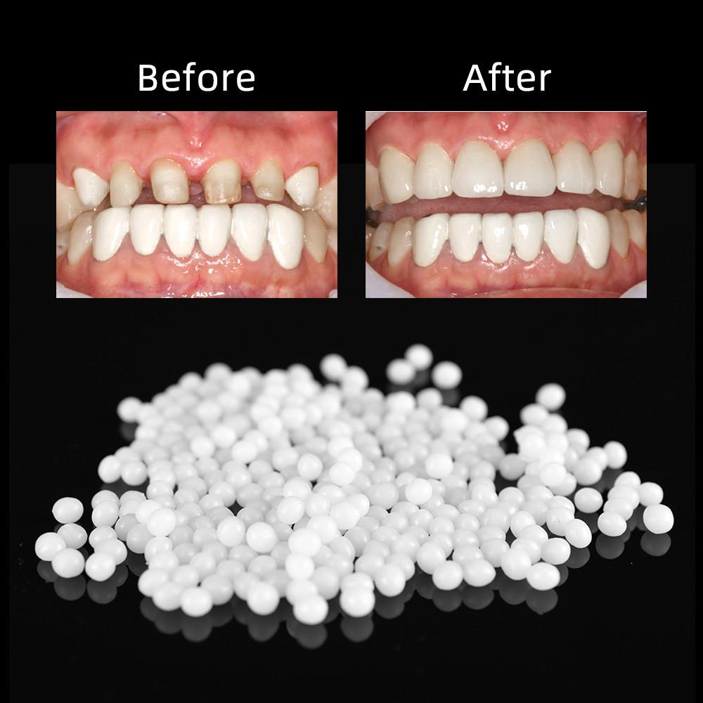 Temporary Tooth Repair Kit Thermal Molding Teeth Repair Replacement Fitting Beads Denture Repair