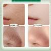 Centella Asiatica Foam Facial Mask, Centella Cleansing Foam Mask,Moisturizing Deep Cleansing Smear Skincare Mask,Pore Clearing Clay Mask,Natural Skinc