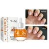 Revitalizing Cuticle Oil - Hydrating Oil For Repaired Cuticles, Remedy For Damaged Skin And Thin Nails