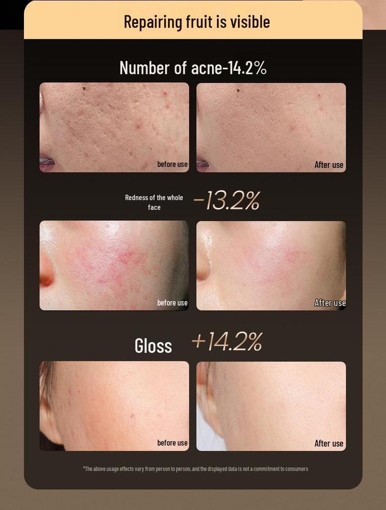 LED Seven-Color Photon Rejuvenation Mask - Beauty Light Therapy Instrument for Home Use