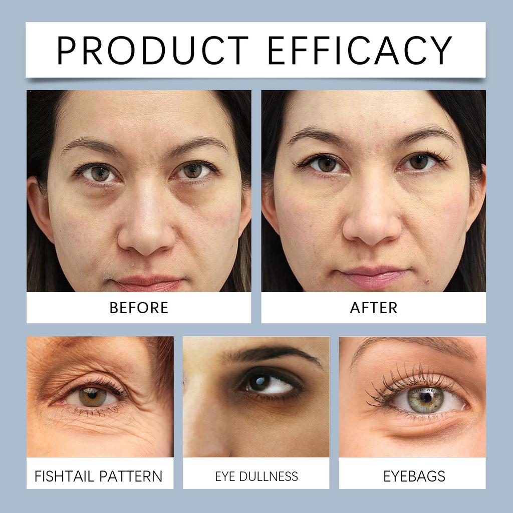 Eye Mask Patch Hydrates And Moisturizes The Skin Around The Eyes, Elasticizes And Reduces Fine Lines, Moisturizes And Brightens Eye Care 2ml