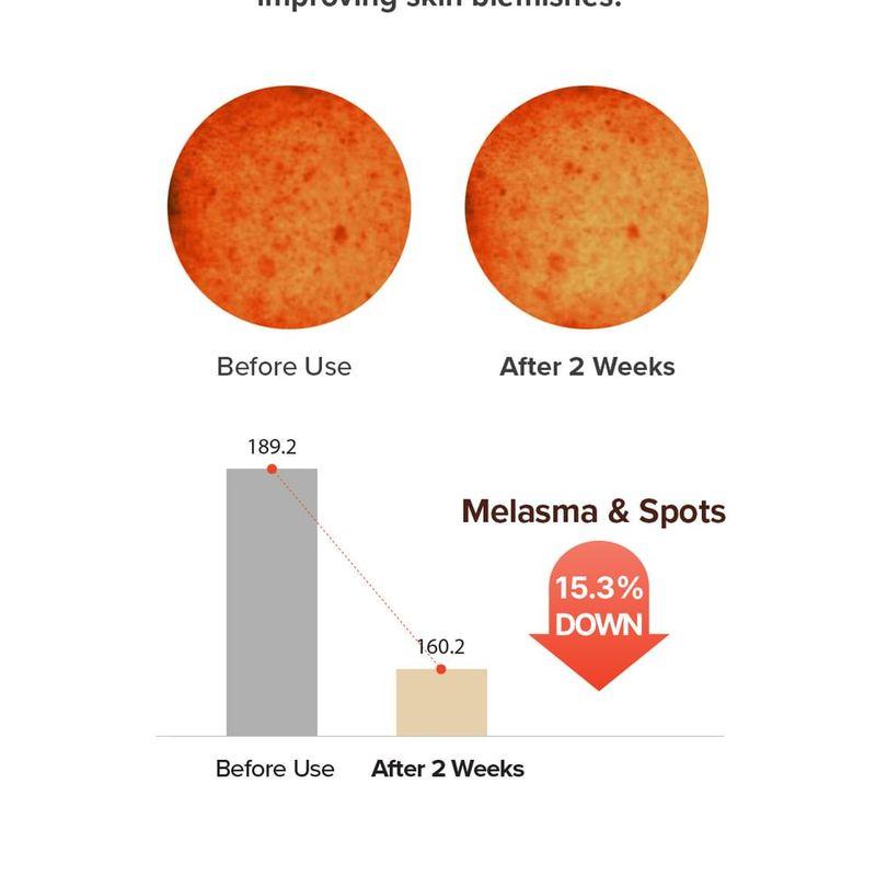 Mary&May - Rice Niacin 10% Triple Vitamin Serum Seoul Edition