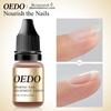 OEDO Nail Repair Treatment Ginseng Nail Essential Oil Nail Art & Tools Healthy Nail Treatment Foot Care