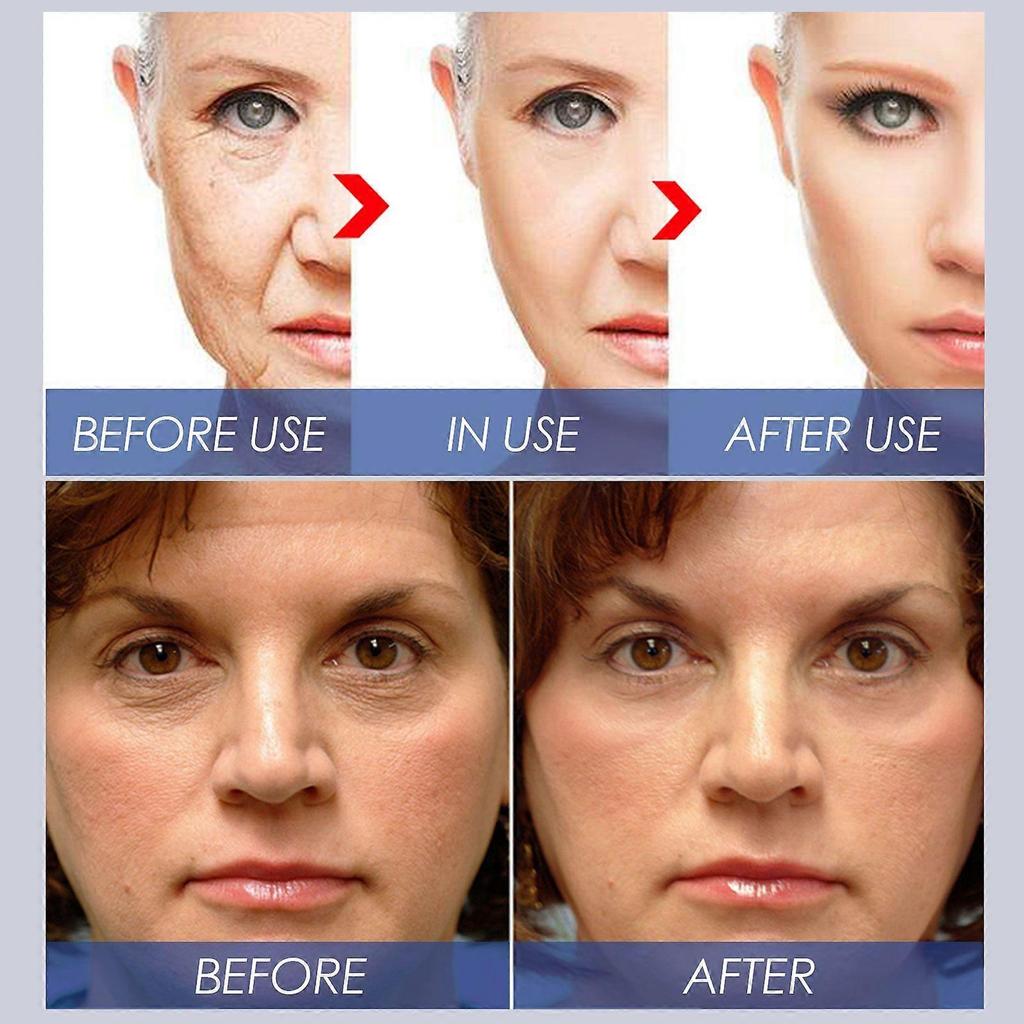 Limited time!!Hoygi Vitamin C Serum - Firming And Anti-Wrinkle Essence, Reduces Fine Lines, Brightens Skin, Hydrating And Moisturizing Serum