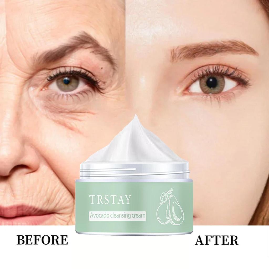 Lighten Black Spot Face Cream Whitening and Brightening Inhibits Antioxidation and Improves Drying