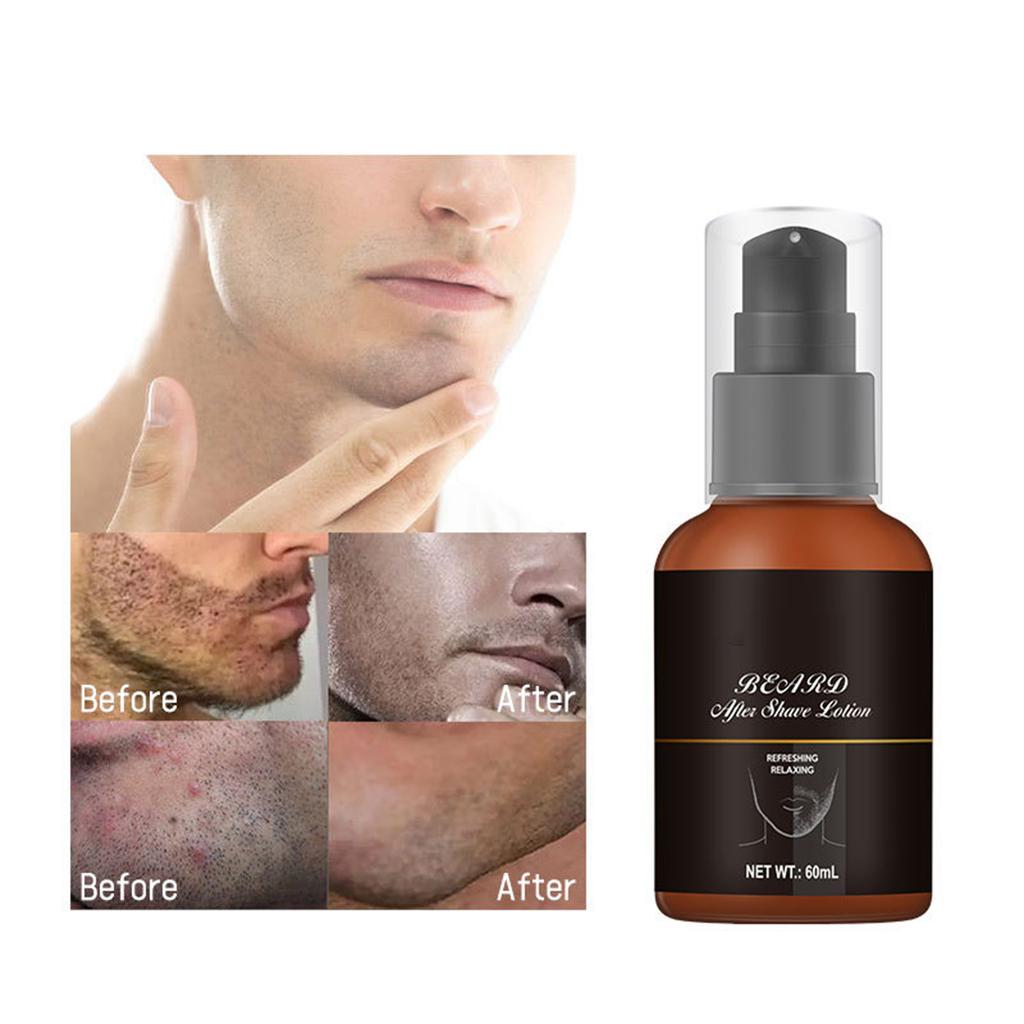 Men’s After-Shave Lotion & Toner – 60ml, Soothes Razor Burn, Reduces Redness, Hydrates Face with Long-Lasting Scent