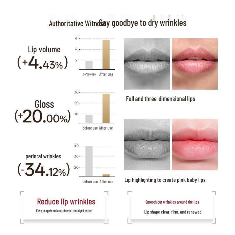 Silk'n Lip Rejuvenation LED Device