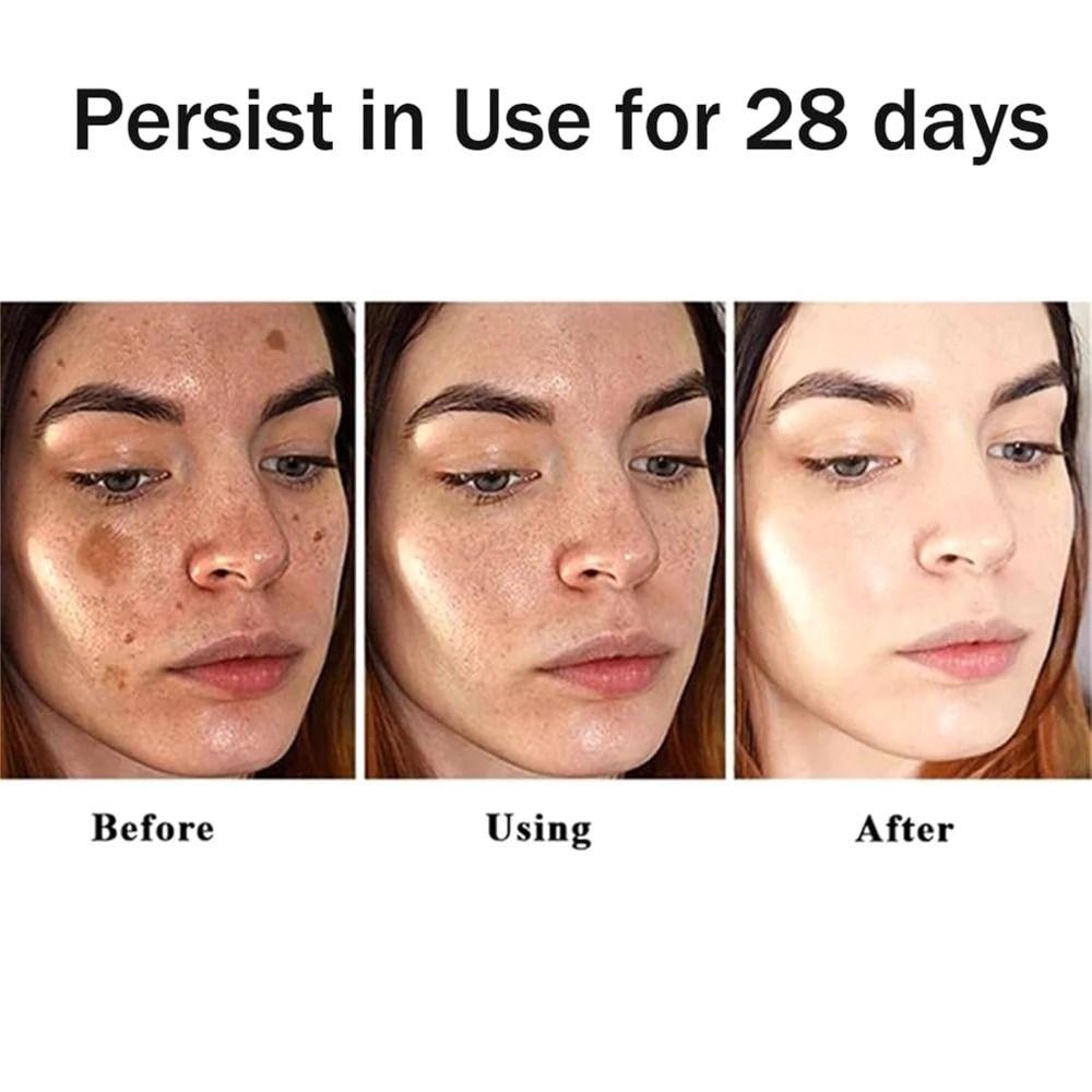 100ml Freckle Removal 377 Essence Oil Long-lasting Face Oil  For Face & Body