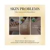 500ml Sterilization Moisturizing Super and Sulfur shower gel Scabies Mites Fat Body Wash Lotion Bath Skin Care Itching