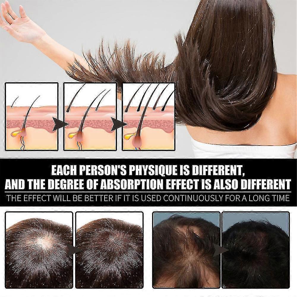 3x Vitamin B7 Hair Essential Oil Treatment Preventing Loss Restorer Essential Oil Biotin Hair Growth Oil 30ml