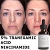 Face Serum with Tranexamic Acid and Niacinamide – Brightening, Hydrating & Firming Care for Even Skin Tone (30ml) Skin Care Serum Restoration