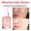 Hoygi Niacinamide Serum Firming & Hydrating Pores Fades Acne Marks & Fine Lines Brightens Skin & Reduces Dark Spots 30ml