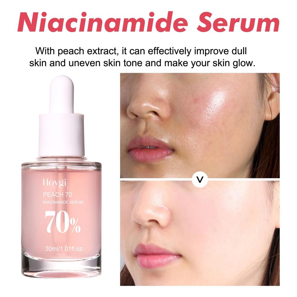 Hoygi Niacinamide Serum Firming & Hydrating Pores Fades Acne Marks & Fine Lines Brightens Skin & Reduces Dark Spots 30ml