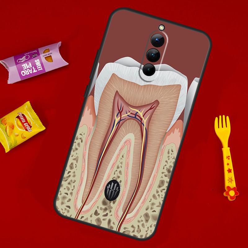 Human Tooth Anatomy Case For ZTE Nubia Red Magic 10 Air 6 6S 7S For Red Magic 11 10 9 8 8S 9S 10S Pro Plus Cover