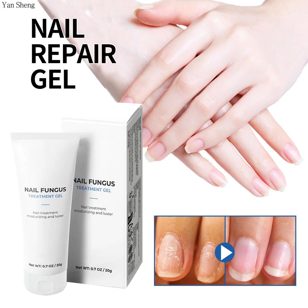 Nail Care Gel Hand Foot Onychomycosis Soft Nail Thickening Nail Luminescent Nail Repair Gel
