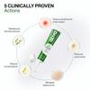 Oziva Spot Corrector for Acne with Green Tea Extract and Willow Bark, 20g