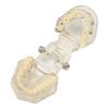 Transparent Dental Implant Pathological Model Implant Disease Teeth Model for Teaching Demonstration