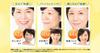 Fracora Proteoglycan Extract Serum, 30mL (1 Bottle) - Collagen, Hyaluronic Acid, Moisturizing